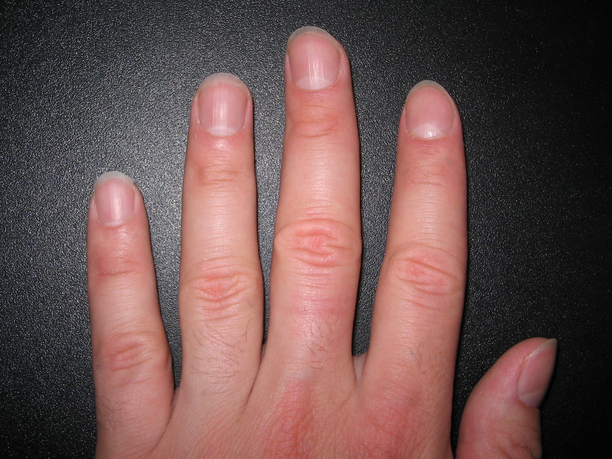 fingernailspublicdomain.jpg